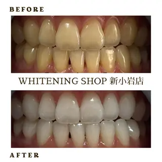 メンズ ホワイトニング ショップ新小岩店のその他イメージ