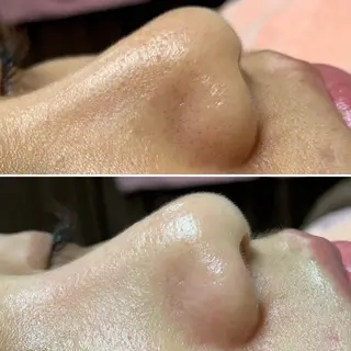 aroma  YURARI所属・韓国艶美人// 毛穴ケア🌹のエステ・リラクイメージ