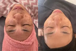 beauty lanaのエステ・リラクイメージ