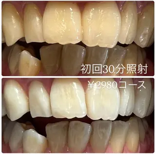 PLATINUM Beauty 横浜店所属・ホワイトニングルーム 横浜店のその他イメージ