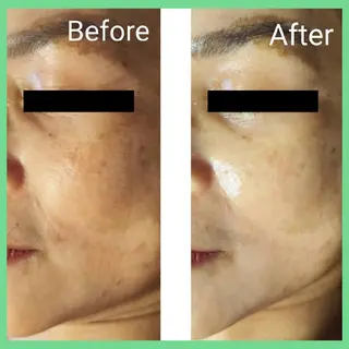 ICHOOSE/ 代々木上原のエステ・リラクイメージ