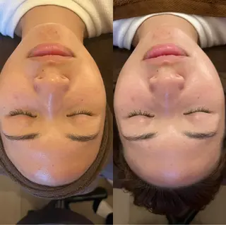 oyam オヤムのエステ・リラクイメージ