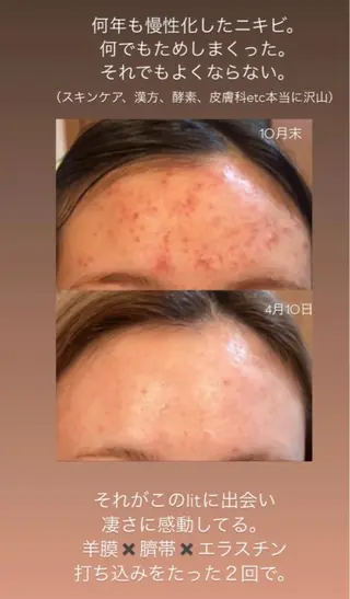 Terra.所属・松村 彩乃のエステ・リラクイメージ