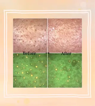 常光 美羽のエステ・リラクイメージ