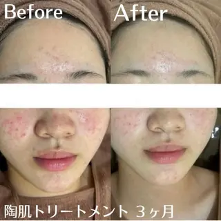 中目黒ハーブピーリン グ🌿ララピールのエステ・リラクイメージ