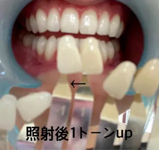 Largo所属・広中 裕一のマツエク・マツパデザイン