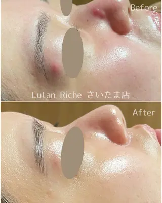 Lutan Richeさいたま店所属・ルタンリッシュ さいたま店のエステ・リラクイメージ