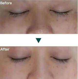 エステサロンNOAH所属・肌育＋脱毛 tomoのエステ・リラクイメージ