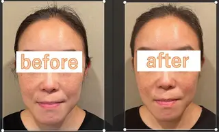 美容鍼灸サロン      APLUS所属・美容鍼灸サロン APLUSのエステ・リラクイメージ