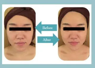 痩身・小顔・美肌専門 Chou chouのエステ・リラクイメージ