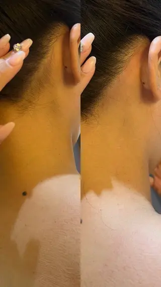 うなじ脱毛/美肌脱毛 LABELのエステ・リラクイメージ