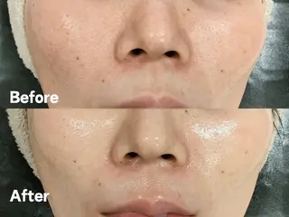 美肌脱毛＆小顔・フェ イシャル【SONA】のエステ・リラクイメージ