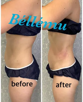 Salon de Béllému所属・Béllému ﾍﾞﾙｴﾐｭ　あおいのエステ・リラクイメージ