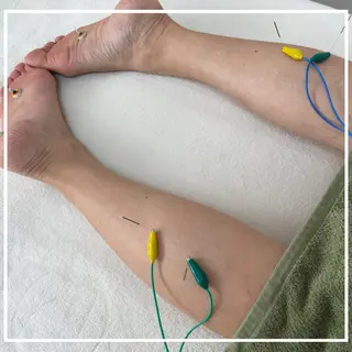 美容鍼灸サロン   colorier所属・美容鍼灸サロン colorierのエステ・リラクイメージ