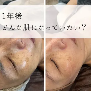 yc.hacci 【ハーブピーリング】のエステ・リラクイメージ