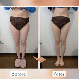 【痩身▪️体質改善ダイエット】美養サロンEnbi～縁美～所属・美養サロンEnbi ～縁美～のエステ・リラクイメージ