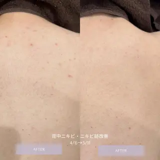 エステサロンTug高知駅前店所属・Tug 高知駅前店/ NANAMIのエステ・リラクイメージ