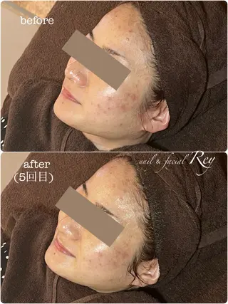 R eyのネイルデザイン