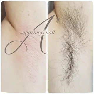 A*《エースター》 シュガーリング🍋のエステ・リラクイメージ