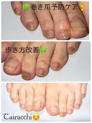 ネイル Tairacchi ﾀｲﾗｯﾁのエステ・リラクイメージ