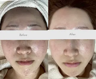 都度払い 肌質改善専門サロンのエステ・リラクイメージ