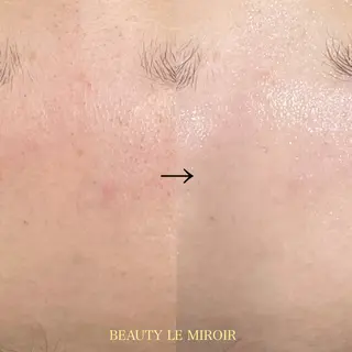 ビューティー ミロワールのエステ・リラクイメージ