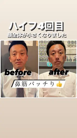 メンズ CRAZY NAILのネイルデザイン