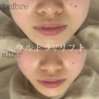 フェイシャルサロン CHIARA 荒田のエステ・リラクイメージ