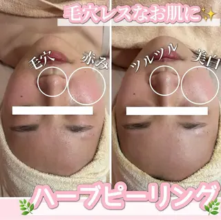 SALON所属・SALON韓国肌管理 東別院のエステ・リラクイメージ