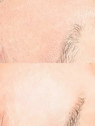 Hit. シュガーリング豊橋のエステ・リラクイメージ