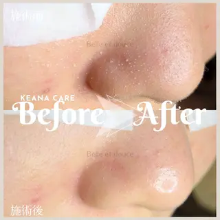 Belle et douce所属・毛穴ケア専門サロン ベルエドゥースのエステ・リラクイメージ