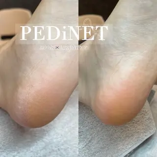 EYE LASH salon fA 【フア】所属・Eyelash fA kananのマツエク・マツパデザイン