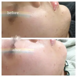 🅖🅤🅩🅔🅛 salonのエステ・リラクイメージ