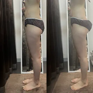 ハイパーナイフ専門店　Salon de COCO所属・Salon de COCOのエステ・リラクイメージ