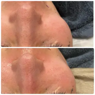 yellow.所属・yellow💛【 脱毛&フェイシャル】のエステ・リラクイメージ