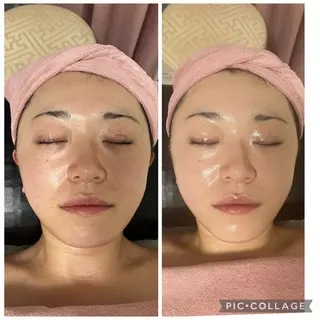 メディカルエステ　痩身·小顔専門サロンBBC 田園調布所属・KEI KOのエステ・リラクイメージ