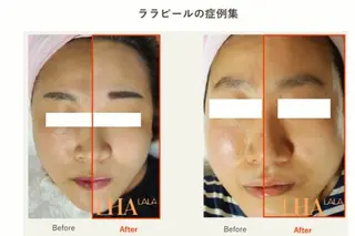 EL.ALLY イーエル.アリーのエステ・リラクイメージ