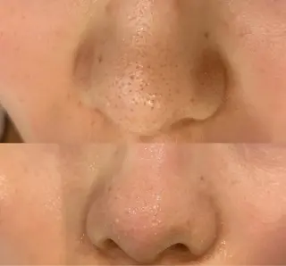 DeI'm   名古屋栄所属・小林 玲菜のエステ・リラクイメージ