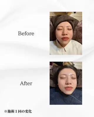 ハーブピーリング🌿 REVI/Ayanoのエステ・リラクイメージ