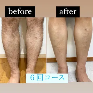 メンズ トータルビューティー サロンCherie2のエステ・リラクイメージ