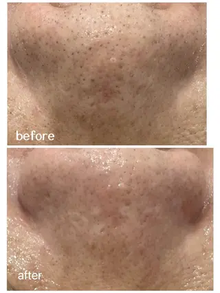 NAVI 韓国肌管理所属・NAVI韓国肌管理《 毛穴/艶肌/小顔》のエステ・リラクイメージ