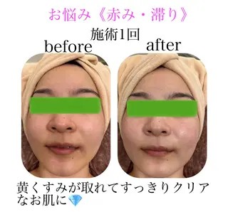 小顔&美肌品川店 Masqueradeのエステ・リラクイメージ