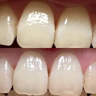 西宮ホワイトニング Kirarie所属・志水 有美のエステ・リラクイメージ