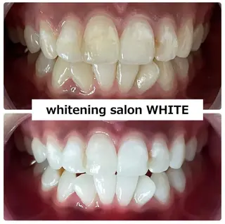 whitening salon WHITE 広島店所属・セルフホワイトニング 専門店WHITE広島のその他イメージ
