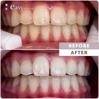 easy　whitening 五反田店所属・イージーホワイト ニング　店長高橋のエステ・リラクイメージ