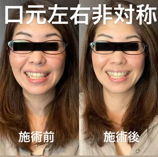 つばさ所属・マッツンの 鍼のその他イメージ