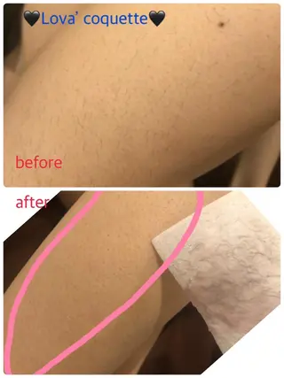 ラヴァコケット 梅田店のエステ・リラクイメージ