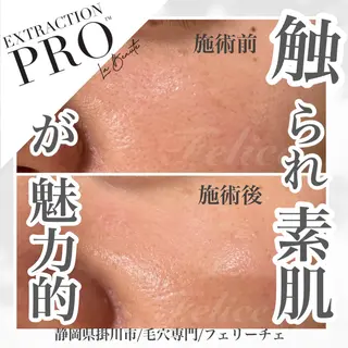 毛穴ケア✖️まつげ Feliceのマツエク・マツパデザイン