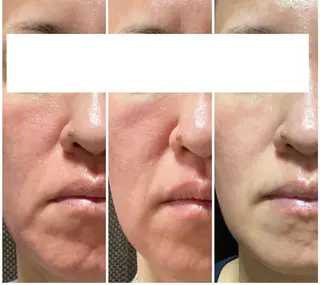 トータルケアサロン meguriのマツエク・マツパデザイン