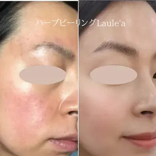 美腸サロン🌺 腸もみ/小顔/リンパのエステ・リラクイメージ